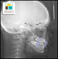 ceph tracing sample